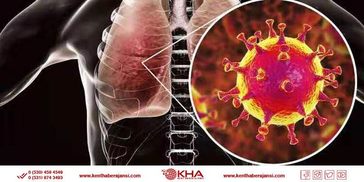 Koronavirüsün belirtileri değişti!