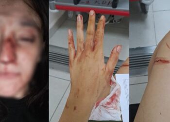 Sultanbeyli’de Eski Sevgili Genç Kıza Dehşeti Yaşattı