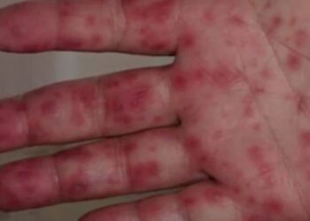 Yeni virüs “domates gribi” alarmı!