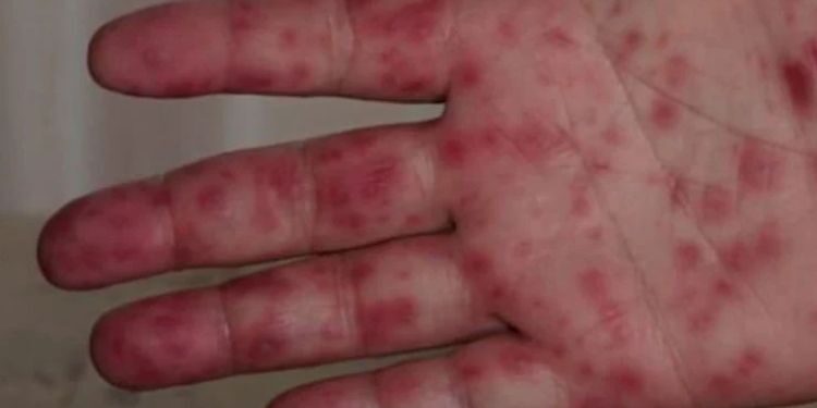 Yeni virüs “domates gribi” alarmı!