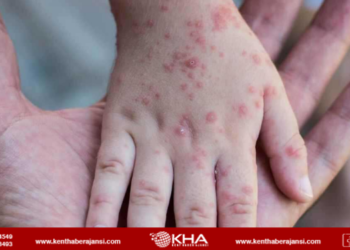 Sağlık Bakanı Koca’dan “kızamık” açıklaması