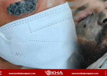 Yeni salgın geliyor: 9 bin vaka tespit edildi!