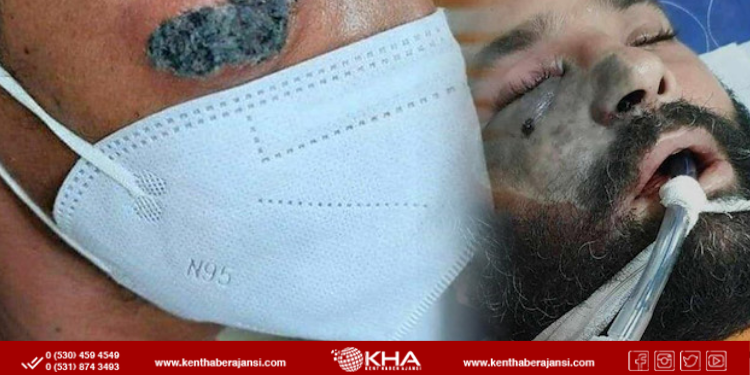 Yeni salgın geliyor: 9 bin vaka tespit edildi!