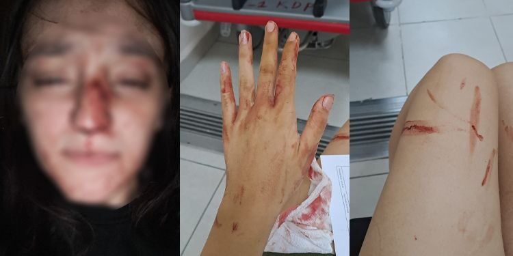 Sultanbeyli’de Eski Sevgili Genç Kıza Dehşeti Yaşattı