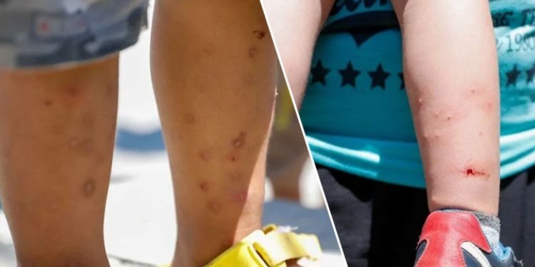 İstanbul’da sivrisinek paniği: Aedes türü artıyor!