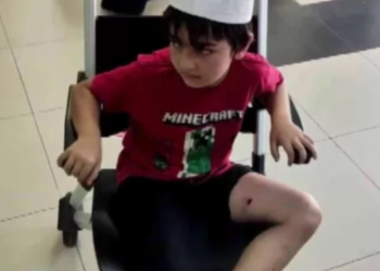 Sultanbeyli’de Bir Çocuk Başıboş Köpeklerin Saldırısına Uğradı