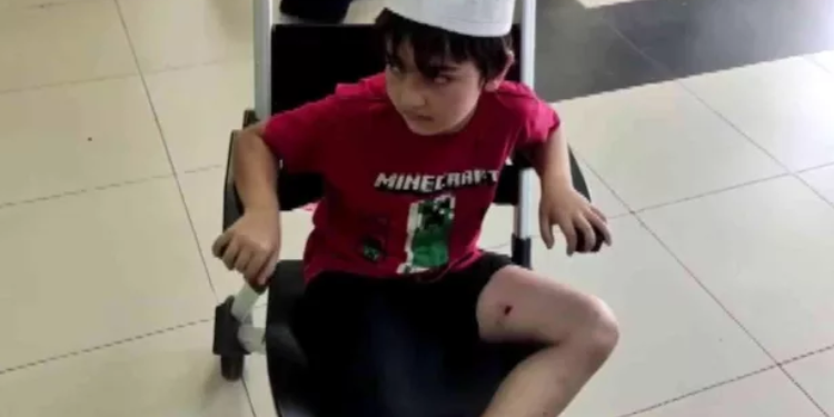 Sultanbeyli’de Bir Çocuk Başıboş Köpeklerin Saldırısına Uğradı