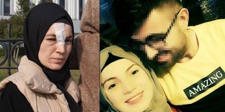 Hatay’da eşinden dayak yiyen kadın KADES’e sığındı!