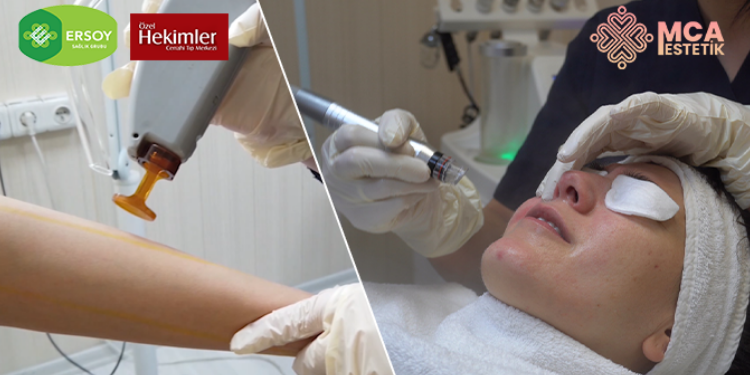 Güzelliğin Merkezi MCA Estetik İle Kalıcı Güzellik…