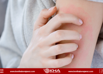 Uyuz vakaları artıyor! Her an herkes olabilir…