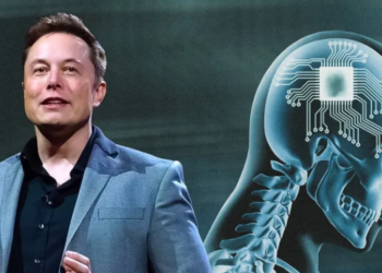 Elon Musk ilk beyin çipini yerleştirdi!