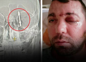 “Bana hayatımı kaybedebileceğimi söylediler”