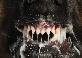 Bu hastalık öldürüyor ve tedavisi yok!