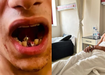 Maganda kurşunu gencin boynundan girdi ağzında kaldı