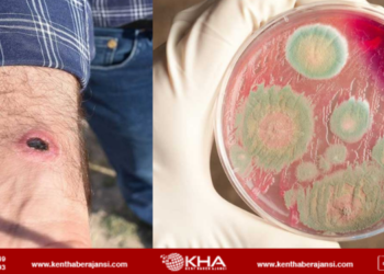 Şarbon Hastalığı Nedir? Şarbon İnsana Bulaşır Mı? Şarbon Hastalığından Nasıl Korunulur?