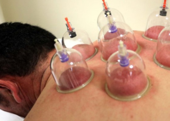 Aile hekimlerine hacamat ve akupunktur yapma yetkisi verilecek!