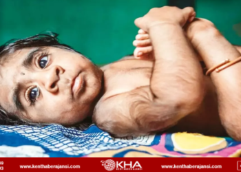 Bebeklerde “Kurt Adam Sendromu” vakası artıyor!