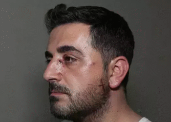 Eski ev sahibine dehşeti yaşattı!