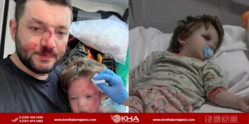 Yalova’da Komşu Kavgası Kanlı Bitti: Baba ve Kızının Kafası Kırıldı