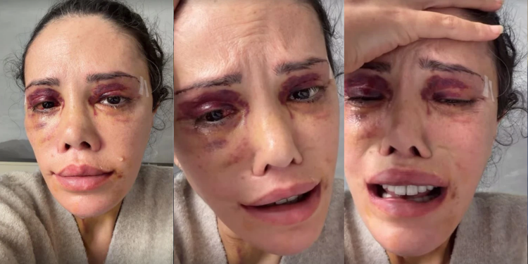 Didem Ceran Gözyaşları İçinde İsyan Etti: “Beni CİMER’e Şikayet Ediyorlar!”